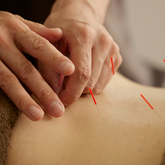 オステオパシーとは